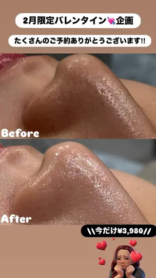 LiZA エステティックサロンのエステ・リラクイメージ