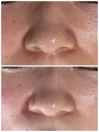 COCO beautyサロンのエステ・リラクイメージ