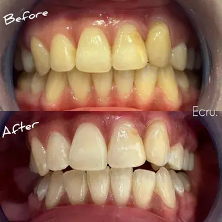 メンズ キッズ ホワイトニングサロン Ecru エクリュのその他イメージ