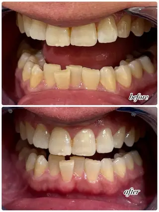 Tieiu ゆりのエステ・リラクイメージ