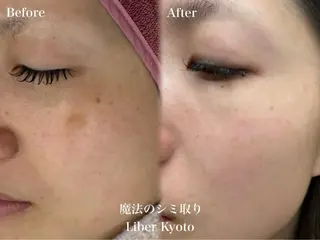 Liber CHIKAのエステ・リラクイメージ