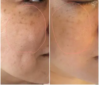 〚博多〛フィユ 水江のマツエク・マツパデザイン