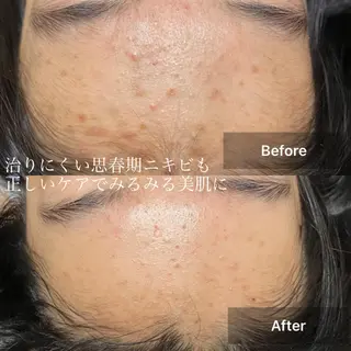 メンズ キッズ 美肌と癒しのサロン Lu,Mieのエステ・リラクイメージ