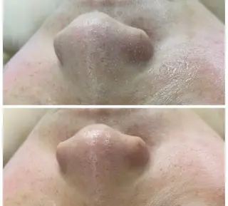 classynail beautyのエステ・リラクイメージ