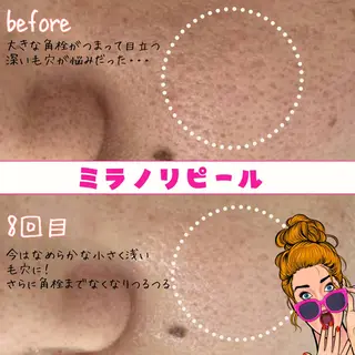 肌質改善サロン chouchouのエステ・リラクイメージ