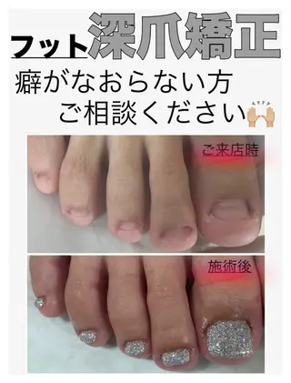 ネイル nail salon petillantのネイルデザイン
