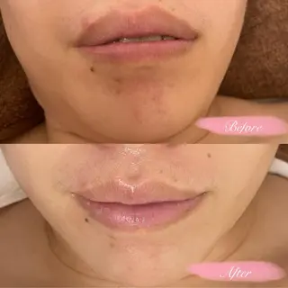 心斎橋　Voyage serein🌙のマツエク・マツパデザイン