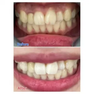 Ｍ渋谷 ホワイトニングのエステ・リラクイメージ