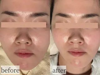 Erika komorebi_のエステ・リラクイメージ