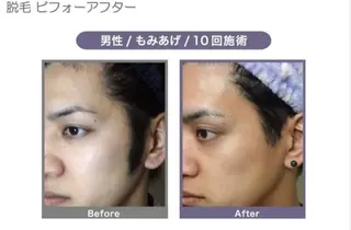 メンズ トータルビューティー サロンCherie2のエステ・リラクイメージ