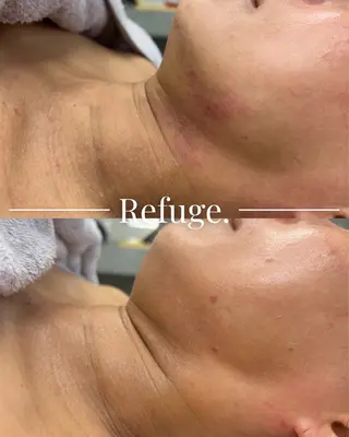 Refuge. （リフュージュ）のエステ・リラクイメージ