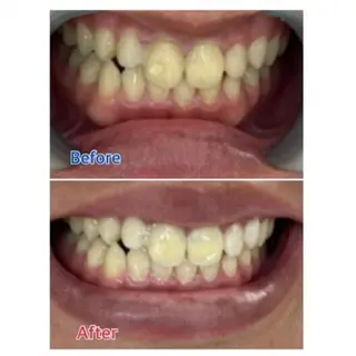 Ｍ渋谷 ホワイトニングのエステ・リラクイメージ