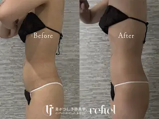 refiel たまプラーザ店所属・藤井 りさのエステ・リラクイメージ