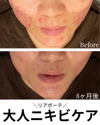 浜野 恵美のエステ・リラクイメージ