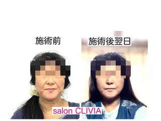 salon CLIVIA, クリヴィア所属・無痛小顔矯正 クリヴィアのエステ・リラクイメージ