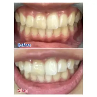 M渋谷 ホワイトニングのエステ・リラクイメージ