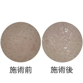 メナード丸の内ヒルズ 柳田りさのエステ・リラクイメージ