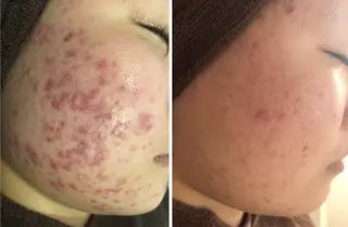 ミディアム カラー パーマ ヘアアレンジ メンズ キッズ ネイル マツエク・マツパ ニキビ・肌質改善専門 ♡人生が変わるサロンのエステ・リラクイメージ