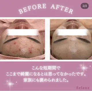 【現役看護師】高来 笑子のエステ・リラクイメージ