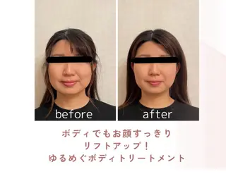 町田・鶴川 小顔矯正 /鈴木友実のエステ・リラクイメージ