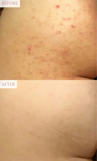 肌質改善専門サロン Bellmi/心斎橋のエステ・リラクイメージ