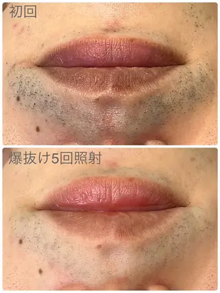 Hisui 小出のエステ・リラクイメージ