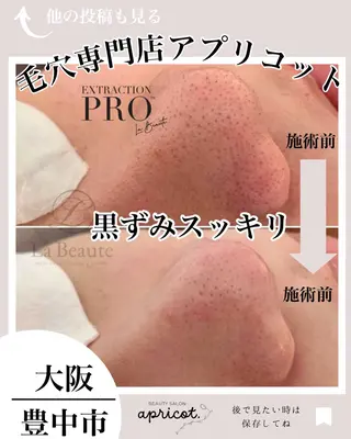 ヘッドスパ専門/豊中 apricotのエステ・リラクイメージ