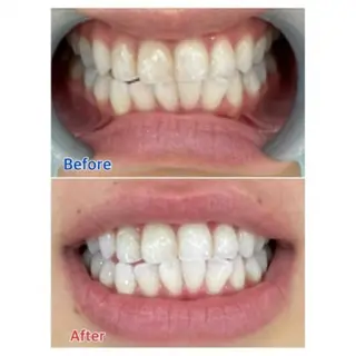 Ｍ渋谷 ホワイトニングのエステ・リラクイメージ