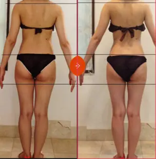 ベルエス 新宿御苑前店のエステ・リラクイメージ