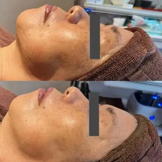 プレイス天王寺店 【肌質改善/ハーブ】のエステ・リラクイメージ