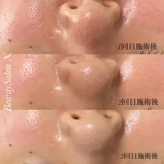 N. 鈴木翔子のエステ・リラクイメージ