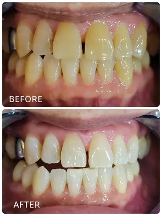 ホワイトニングサロン ラウレアのその他イメージ