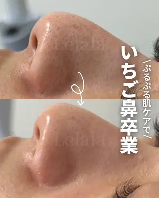 Salon Lelalaのエステ・リラクイメージ