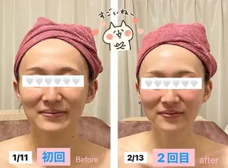35歳からの エイジングケアサロンのエステ・リラクイメージ