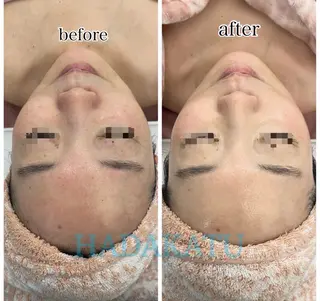 総合エステサロン 肌活のエステ・リラクイメージ