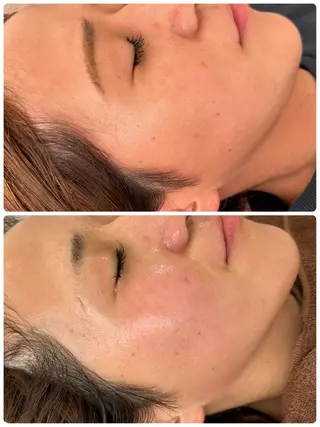 beauty  salon sorelle所属・産毛角質ケア/艶肌 フェイシャルワックスのエステ・リラクイメージ