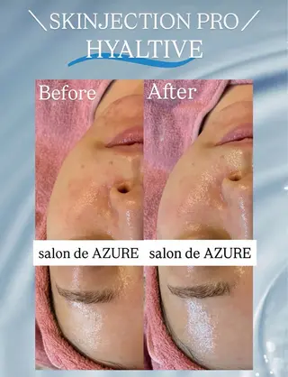 salon de AZUREのエステ・リラクイメージ