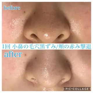 ロング カラー パーマ ヘアアレンジ キッズ ネイル マツエク・マツパ EnsorClair 代表 野口真央のエステ・リラクイメージ