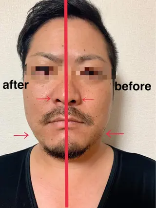 痩身/脱毛/ネイル HARUKAのエステ・リラクイメージ