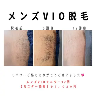 メンズ private脱毛salon HALE所属・private脱毛 salon HALEのエステ・リラクイメージ
