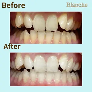 Blanche 心斎橋のその他イメージ