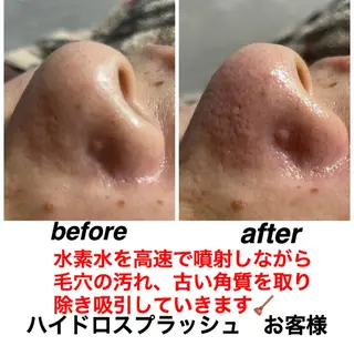 ネイル・エステサロン UILANIのネイルデザイン