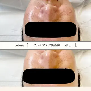 ~la lean~ ﾘｱﾝのエステ・リラクイメージ