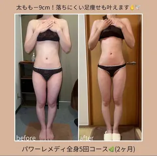 《本気痩せ×疲労改善 》  BILOOPのエステ・リラクイメージ
