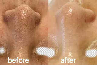 Nature Souce毛穴専門店のその他イメージ