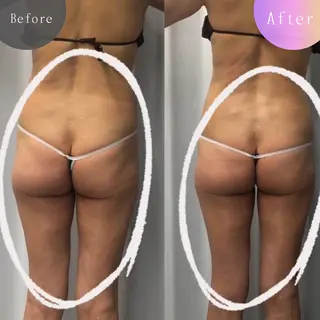 痩身・脱毛・肌管理 Rechica心斎橋のエステ・リラクイメージ