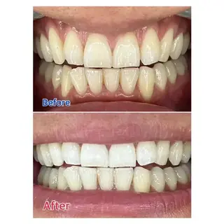 M渋谷 ホワイトニングのエステ・リラクイメージ