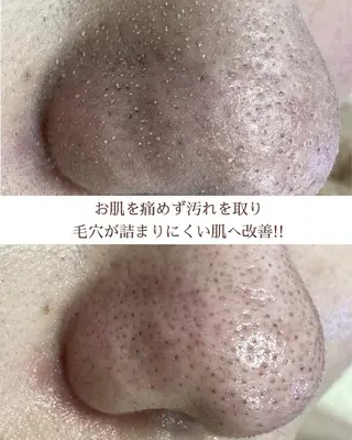 都度払い 肌質改善専門サロンのエステ・リラクイメージ