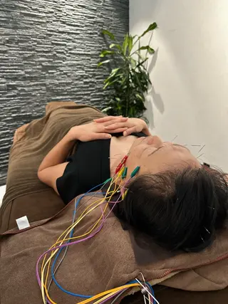 小顔矯/美容鍼/鍼灸 BeauJuのその他イメージ
