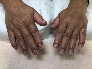 ネイル 松岡 明未夏のネイルデザイン